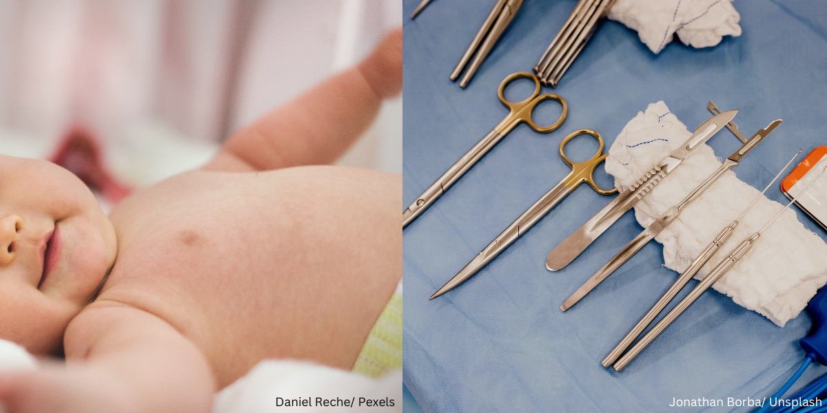 Adakah Terdapat Pendapat Berlainan Dalam Islam Mengenai Sunat atau Khitan Wanita?