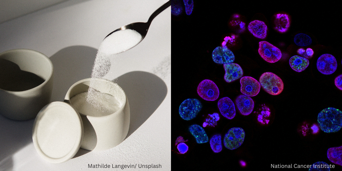 Adakah Pengambilan Gula Berlebihan Mempunyai Hubung Kait Dengan Risiko Kanser?