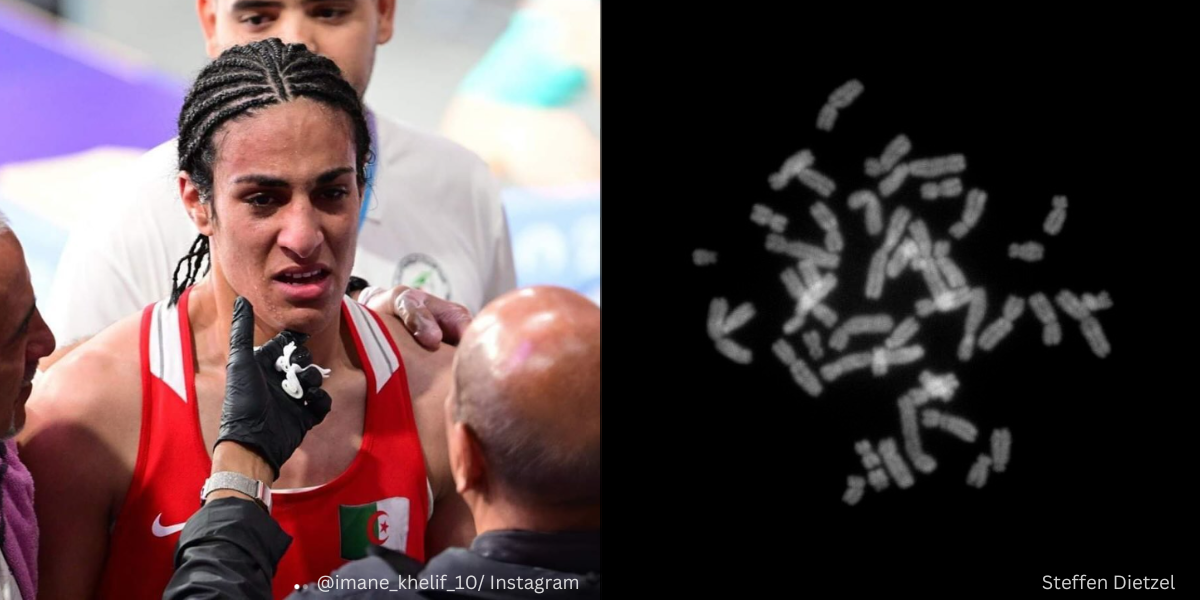 Benarkah Wanita Boleh Memiliki Kromosom Y & Kadar Hormon Testosteron Yang Tinggi?